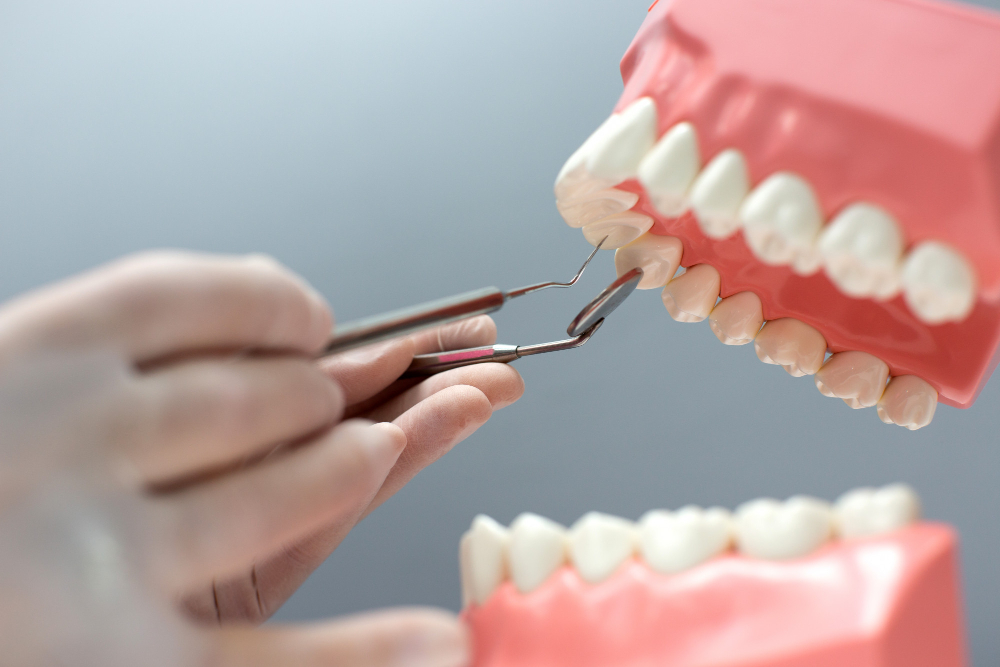 Coroana dentară: soluția ideală pentru un zâmbet durabil